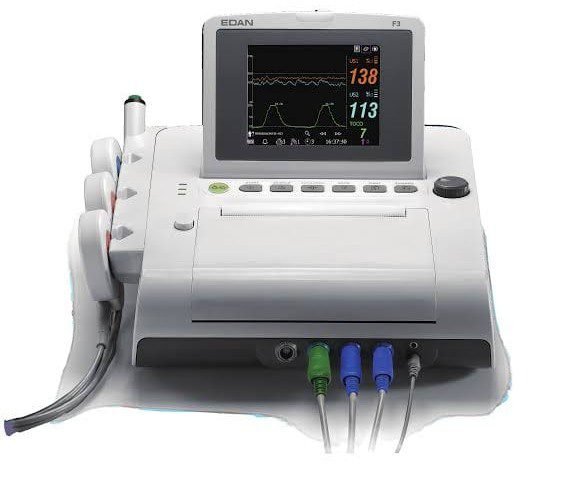 Fetal Monitor (CTG) for pregnancy monitoring available at Magnus Medical Systems in Nellore